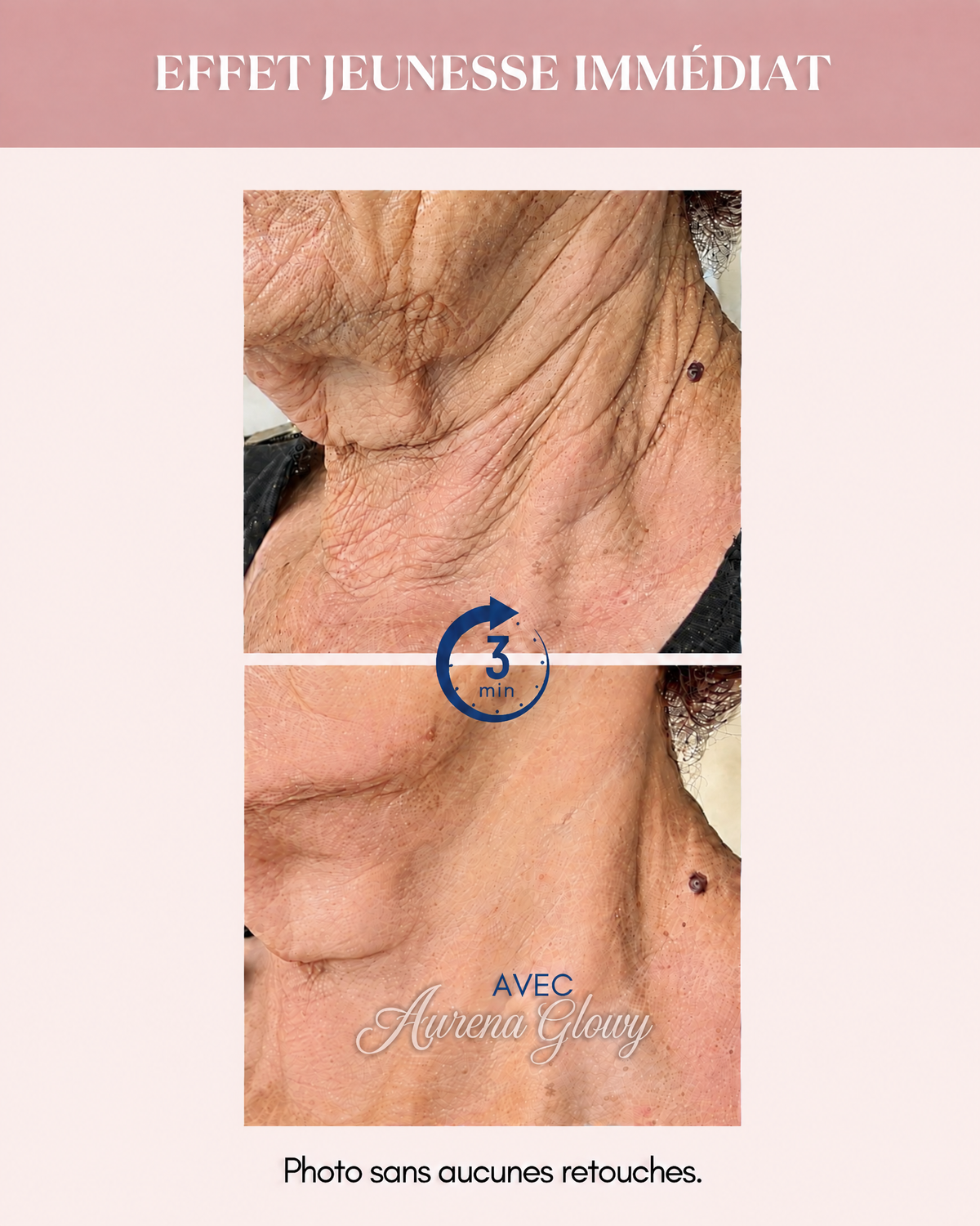 Aurena Serum Anti Ride
