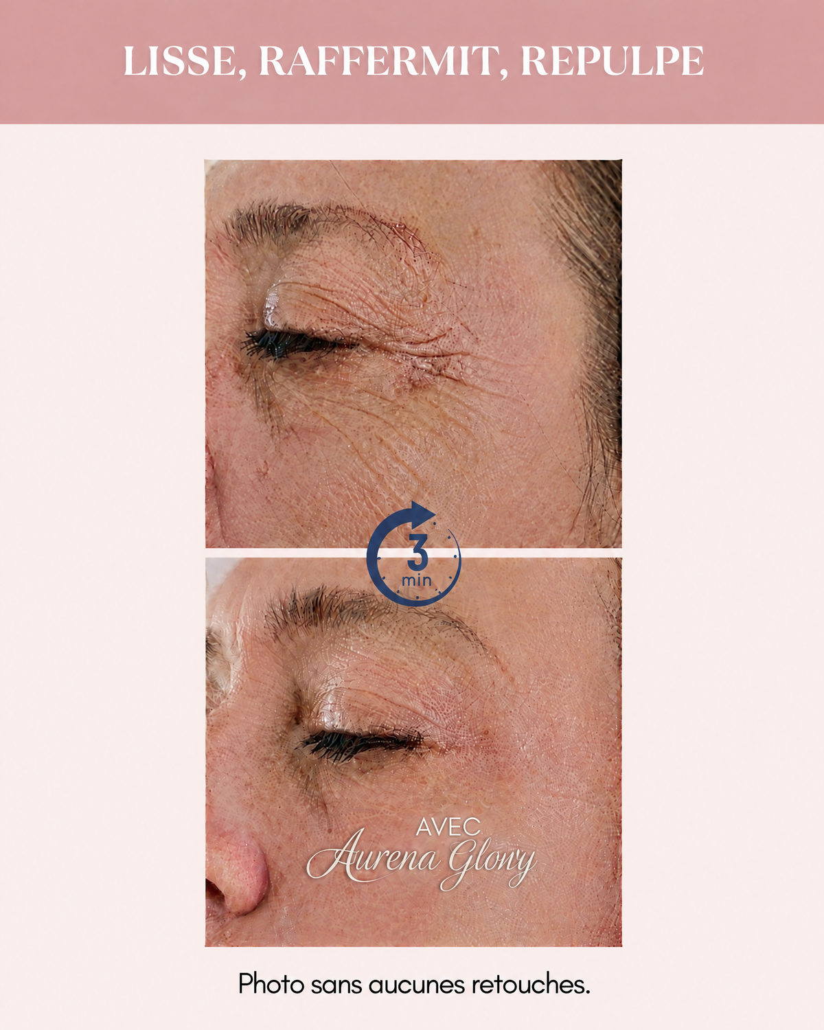 Aurena Serum Anti Ride