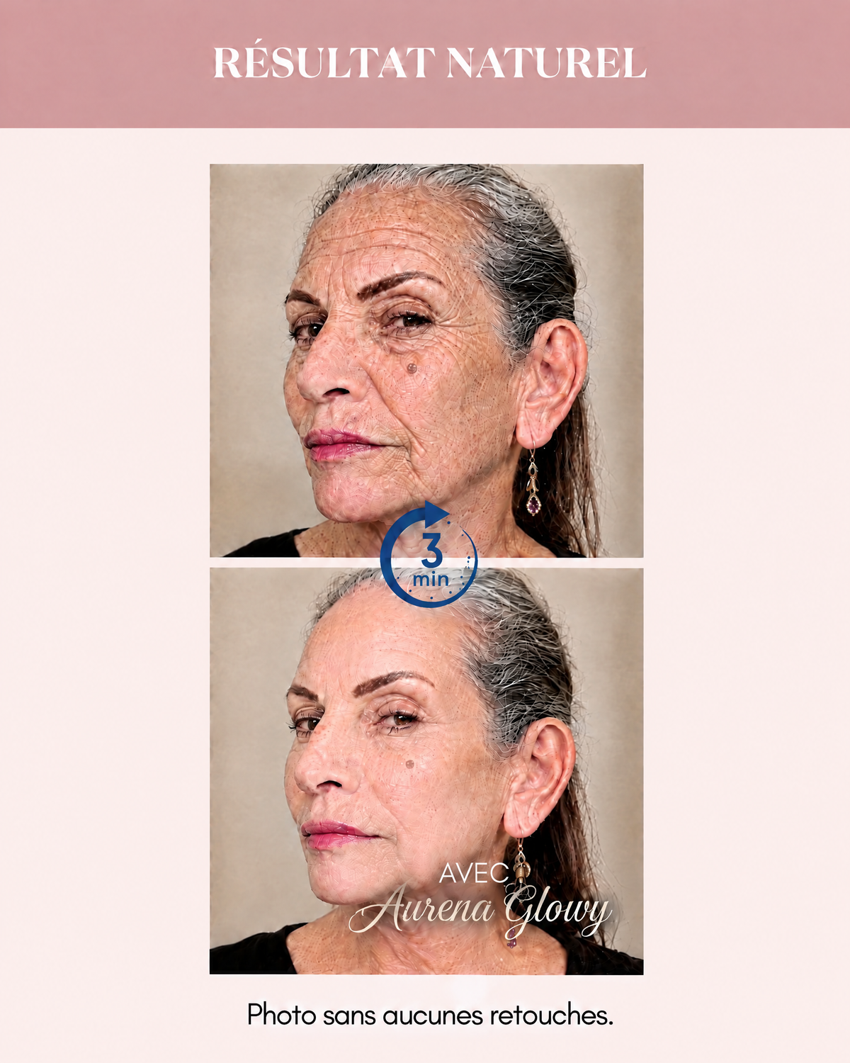 Aurena Serum Anti Ride